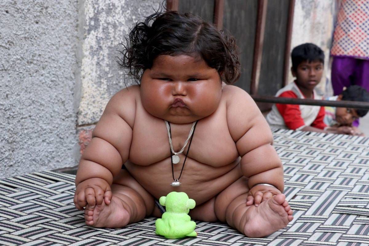 Conheça Chahat Kumar, a bebê mais gorda do mundo – Metro World News Brasil