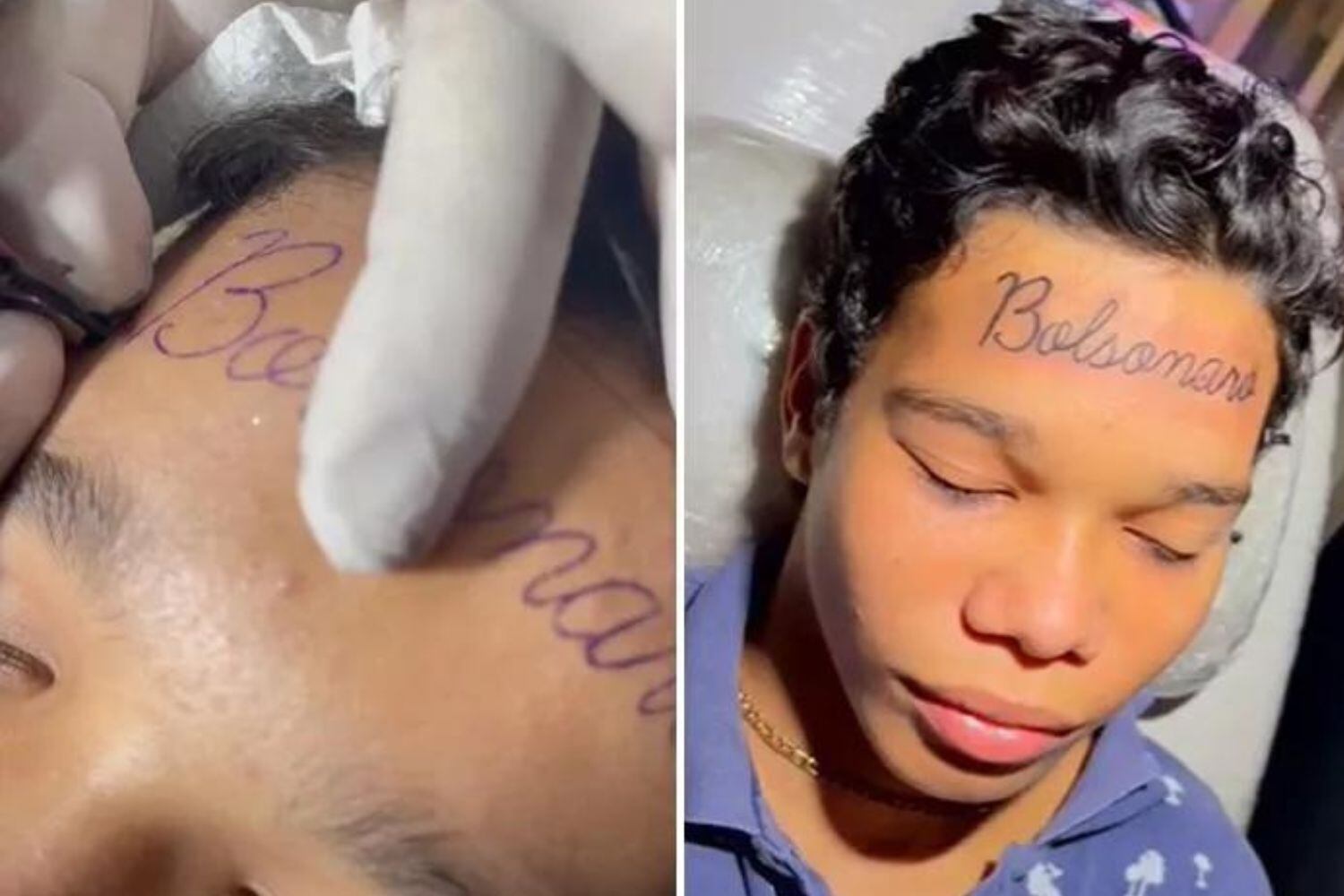 Vídeo: Adolescente de 17 anos tatua o nome de Bolsonaro na testa e viraliza