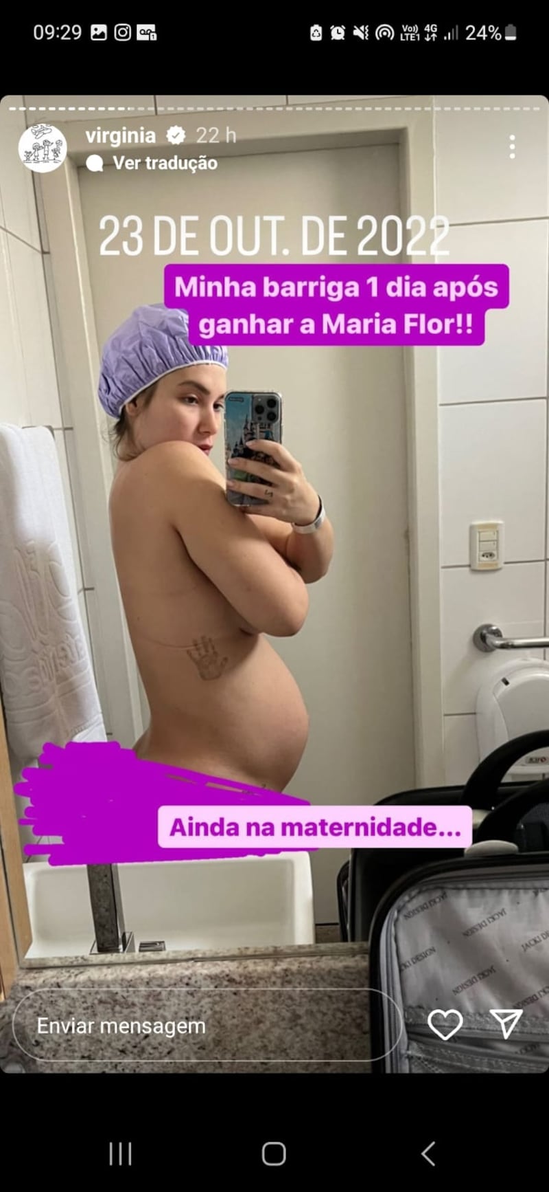 A influenciadora postou uma foto mostrando como ficou a sua barriga após ganhar a caçula, Maria Flor
Foto: @virginia