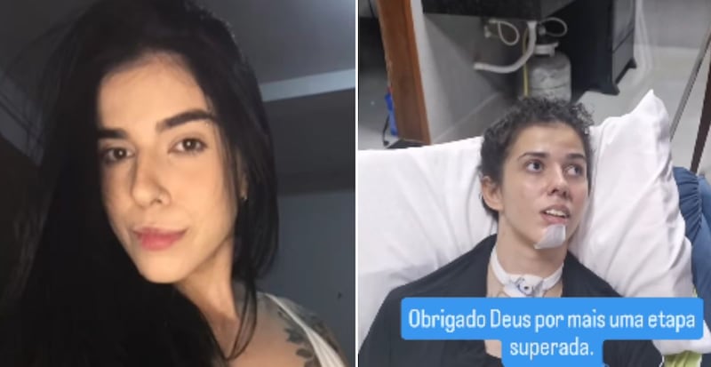 Jovem teve crise grave de asma ao cheirar pimenta e quase morreu