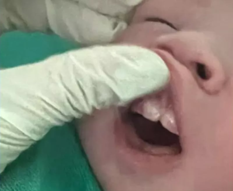 Essa é a verdade por trás do bebê que nasceu com seis dentes no Mato Grosso do Sul