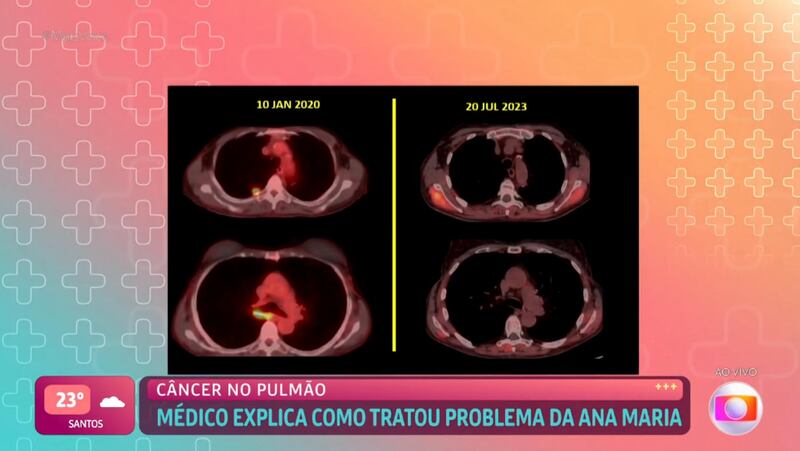 Comparação dos exames de Ana Maria Braga de 2020 e. agora, na última semana