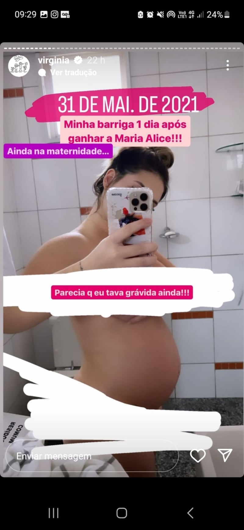 A influenciadora postou uma foto mostrando como ficou a sua barriga após ganhar a Maria Alice
Foto: @virginia