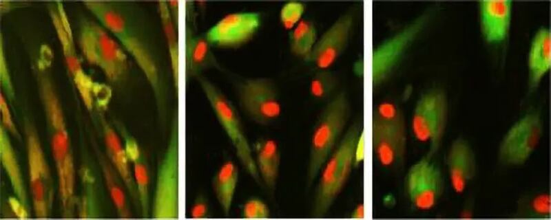 Cientistas De Harvard E Do Mit Descobriram Coquetéis Para Reverter O Envelhecimento Metro